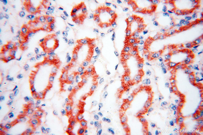 ANT1/2 Antibody in Immunohistochemistry (Paraffin) (IHC (P))