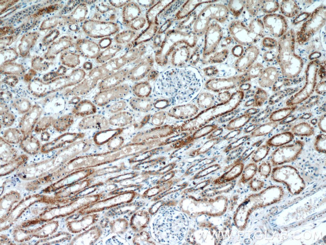 ANT1/2 Antibody in Immunohistochemistry (Paraffin) (IHC (P))