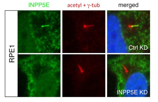 INPP5E Antibody in Immunocytochemistry (ICC/IF)