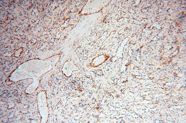 INPP5E Antibody in Immunohistochemistry (Paraffin) (IHC (P))