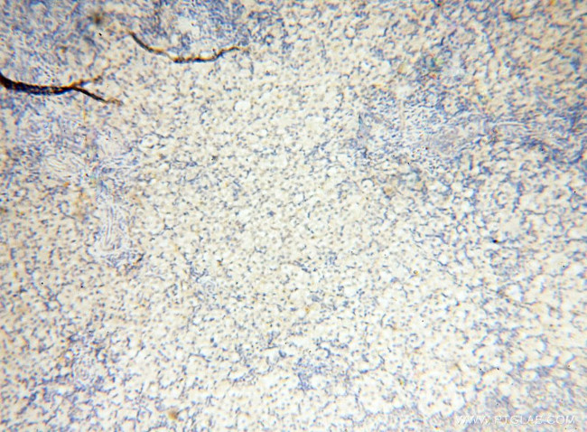 INPP5E Antibody in Immunohistochemistry (Paraffin) (IHC (P))