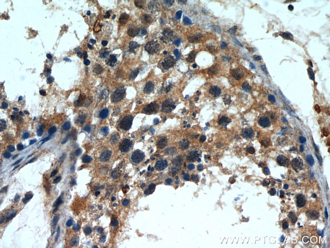 INPP5E Antibody in Immunohistochemistry (Paraffin) (IHC (P))