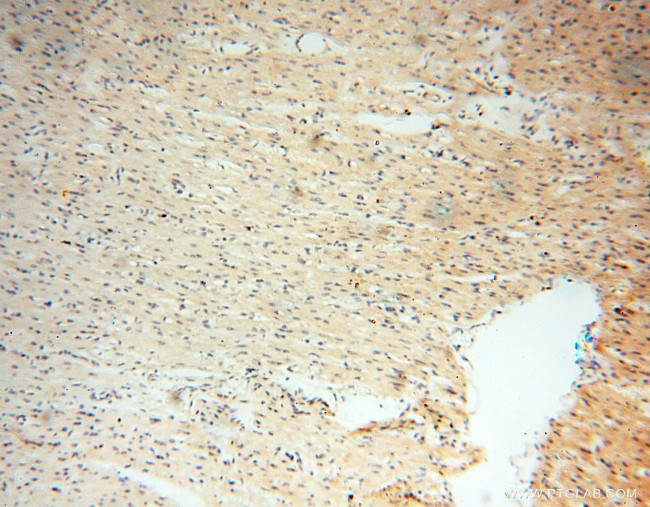 INPP5E Antibody in Immunohistochemistry (Paraffin) (IHC (P))