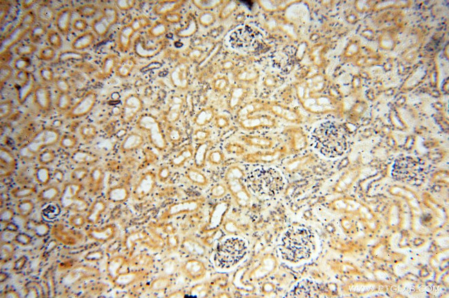 INPP5E Antibody in Immunohistochemistry (Paraffin) (IHC (P))