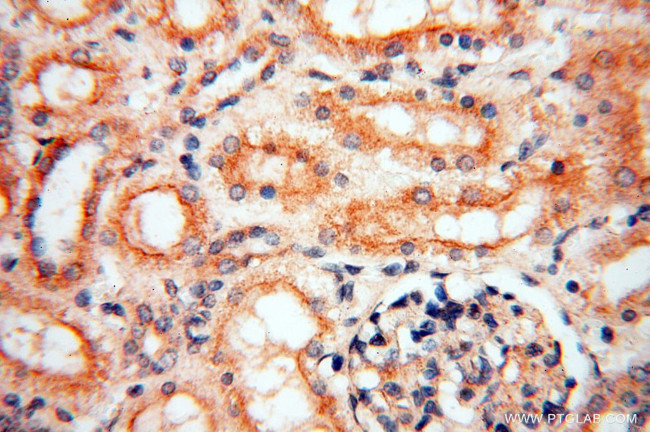 INPP5E Antibody in Immunohistochemistry (Paraffin) (IHC (P))