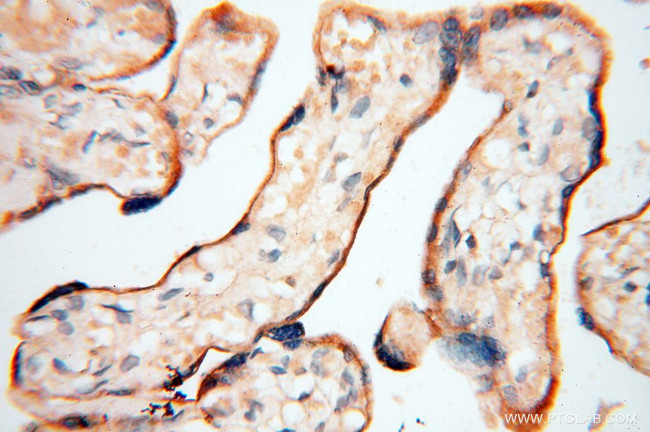 INPP5E Antibody in Immunohistochemistry (Paraffin) (IHC (P))