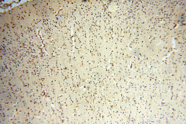 INPP5E Antibody in Immunohistochemistry (Paraffin) (IHC (P))