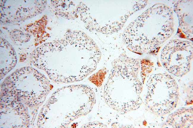 INPP5E Antibody in Immunohistochemistry (Paraffin) (IHC (P))