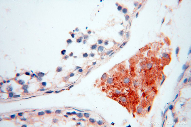 INPP5E Antibody in Immunohistochemistry (Paraffin) (IHC (P))