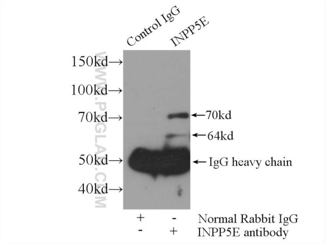 INPP5E Antibody in Immunoprecipitation (IP)