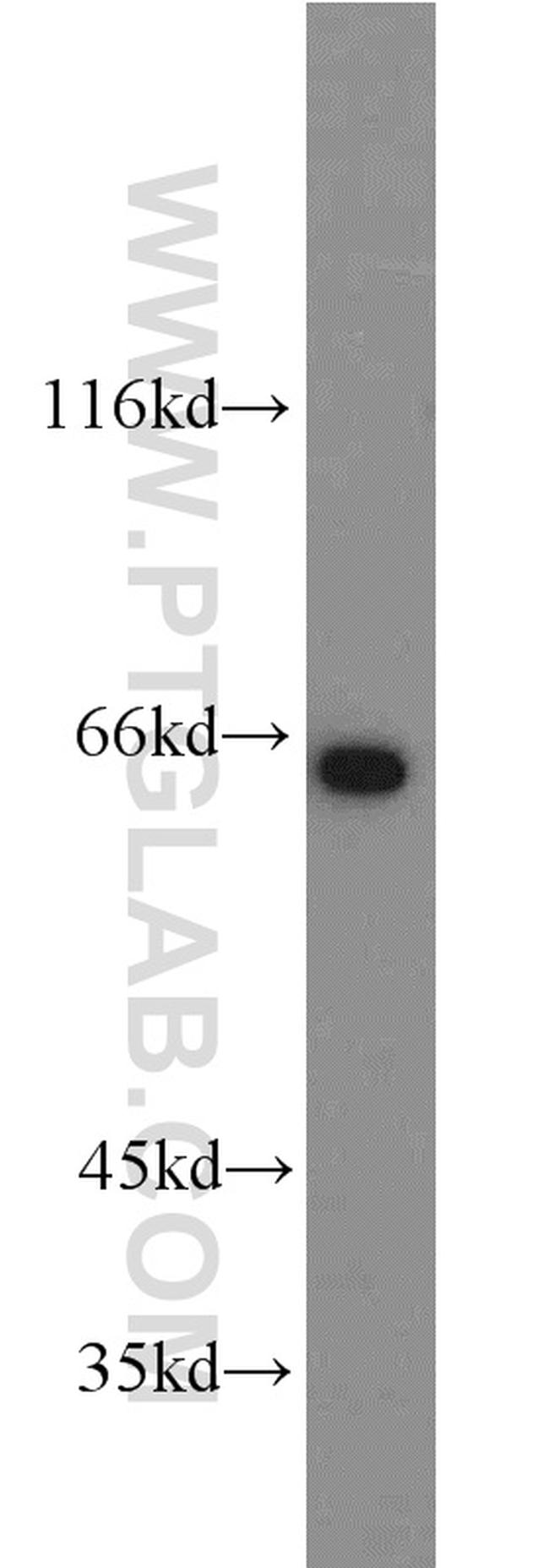 INPP5E Antibody in Western Blot (WB)