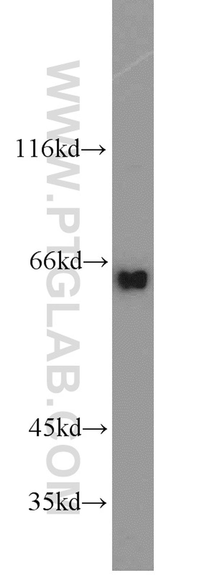 INPP5E Antibody in Western Blot (WB)