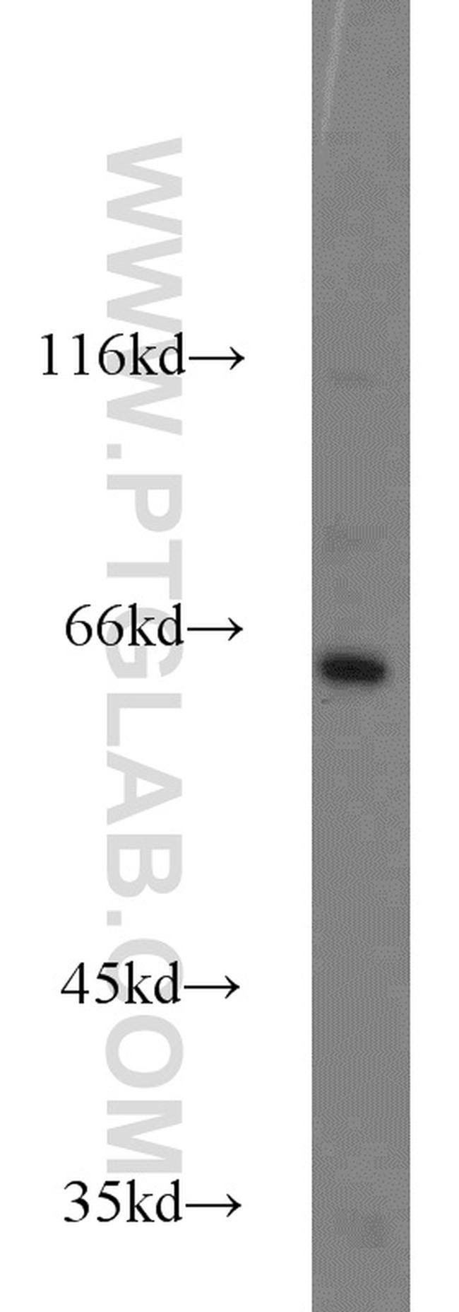 INPP5E Antibody in Western Blot (WB)