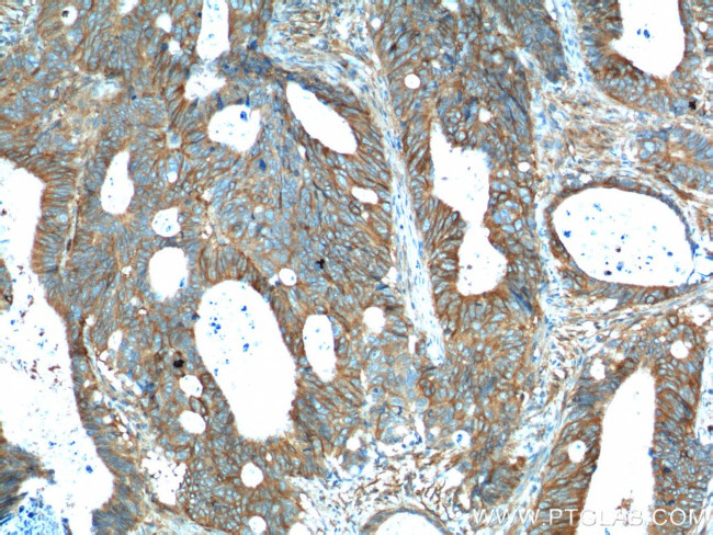 PTK7 Antibody in Immunohistochemistry (Paraffin) (IHC (P))