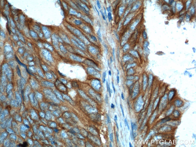 PTK7 Antibody in Immunohistochemistry (Paraffin) (IHC (P))