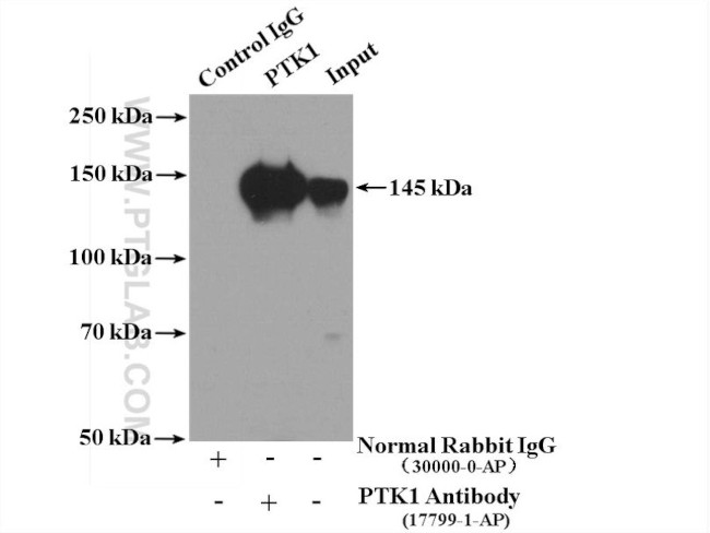 PTK7 Antibody in Immunoprecipitation (IP)