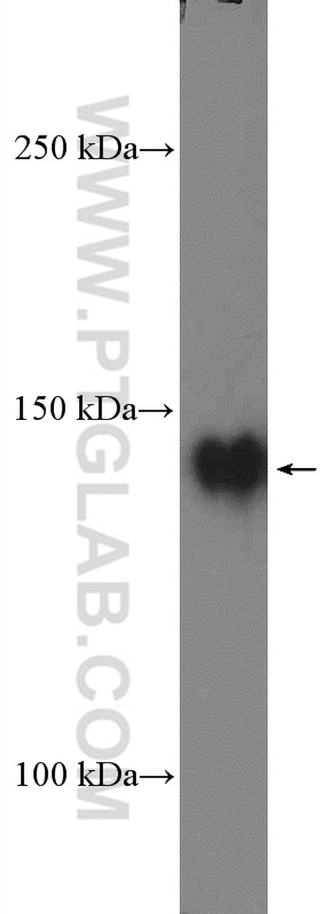 PTK7 Antibody in Western Blot (WB)