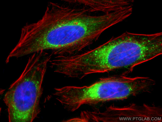 Calumenin Antibody in Immunocytochemistry (ICC/IF)