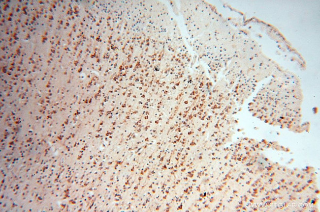 Calumenin Antibody in Immunohistochemistry (Paraffin) (IHC (P))