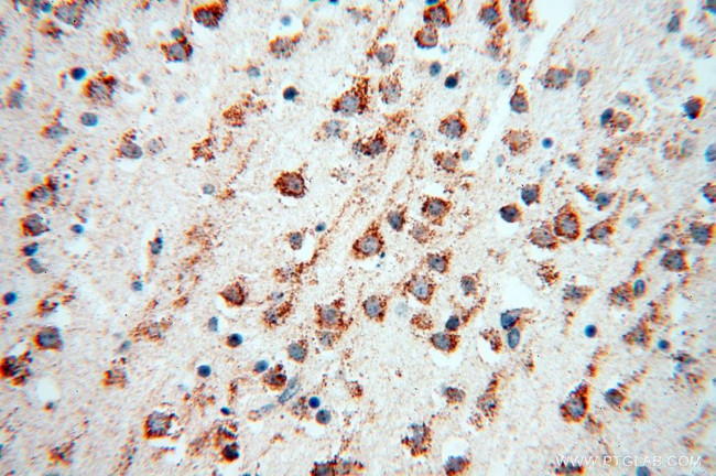 Calumenin Antibody in Immunohistochemistry (Paraffin) (IHC (P))