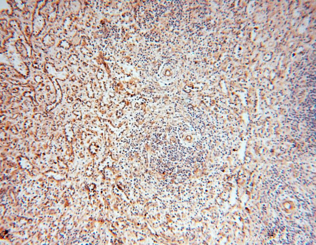 Calumenin Antibody in Immunohistochemistry (Paraffin) (IHC (P))