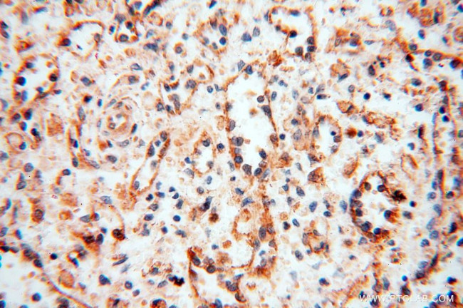 Calumenin Antibody in Immunohistochemistry (Paraffin) (IHC (P))