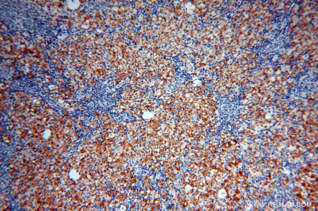 Calumenin Antibody in Immunohistochemistry (Paraffin) (IHC (P))