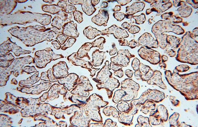 Calumenin Antibody in Immunohistochemistry (Paraffin) (IHC (P))