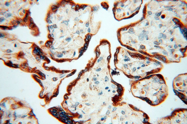 Calumenin Antibody in Immunohistochemistry (Paraffin) (IHC (P))