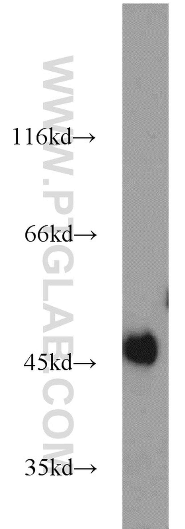 Calumenin Antibody in Western Blot (WB)