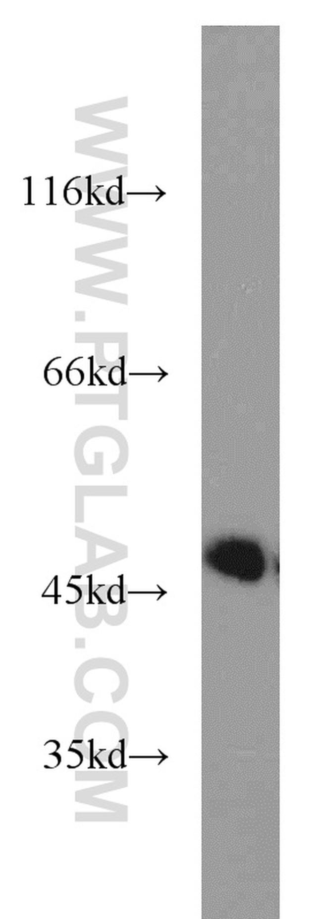 Calumenin Antibody in Western Blot (WB)