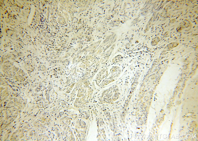 SERP1 Antibody in Immunohistochemistry (Paraffin) (IHC (P))