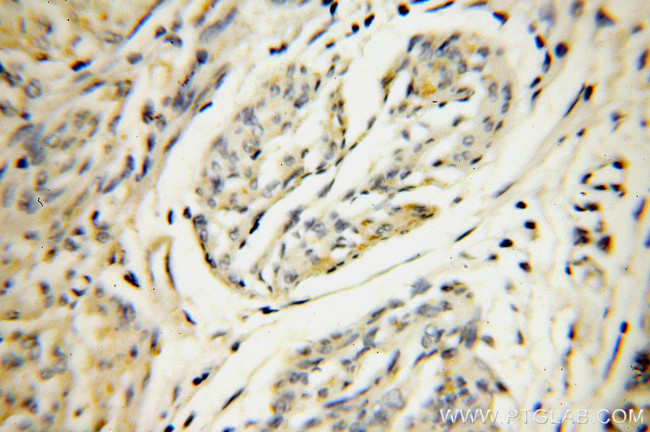 SERP1 Antibody in Immunohistochemistry (Paraffin) (IHC (P))