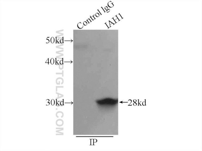 IAH1 Antibody in Immunoprecipitation (IP)