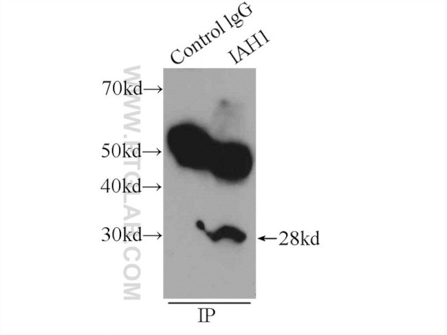 IAH1 Antibody in Immunoprecipitation (IP)