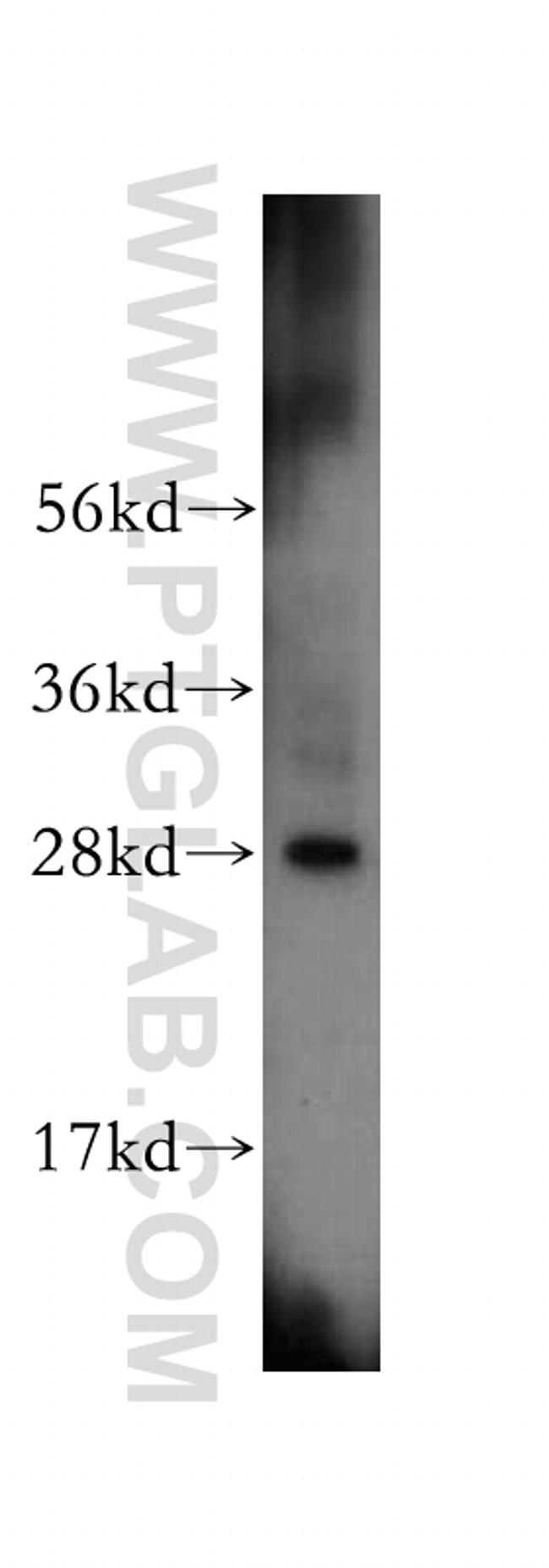 IAH1 Antibody in Western Blot (WB)