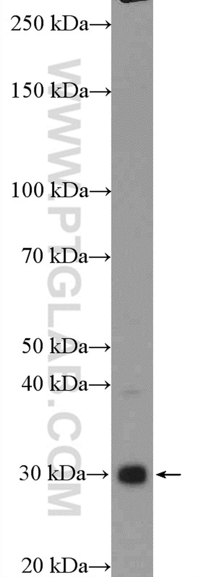 RNF4 Antibody in Western Blot (WB)