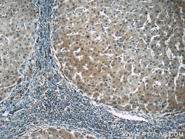 PGK1 Antibody in Immunohistochemistry (Paraffin) (IHC (P))