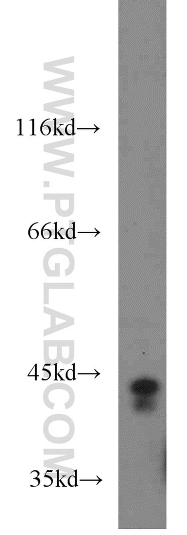 PGK1 Antibody in Western Blot (WB)