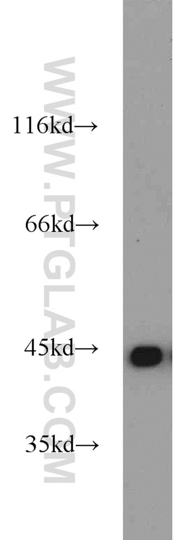 PGK1 Antibody in Western Blot (WB)