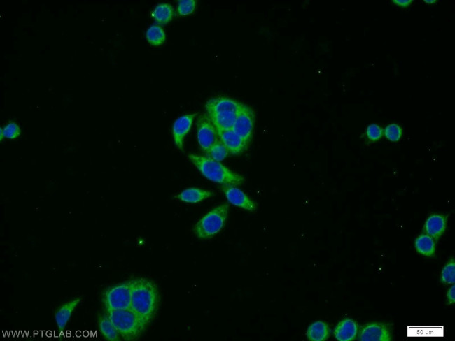 PRPSAP2 Antibody in Immunocytochemistry (ICC/IF)