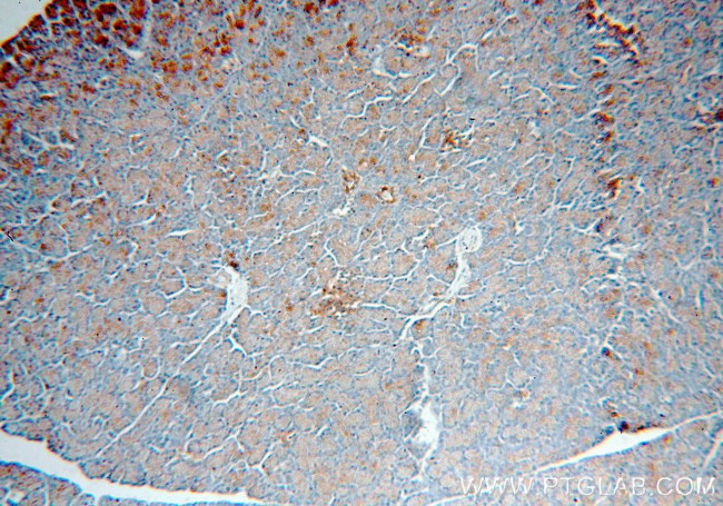 PRPSAP2 Antibody in Immunohistochemistry (Paraffin) (IHC (P))