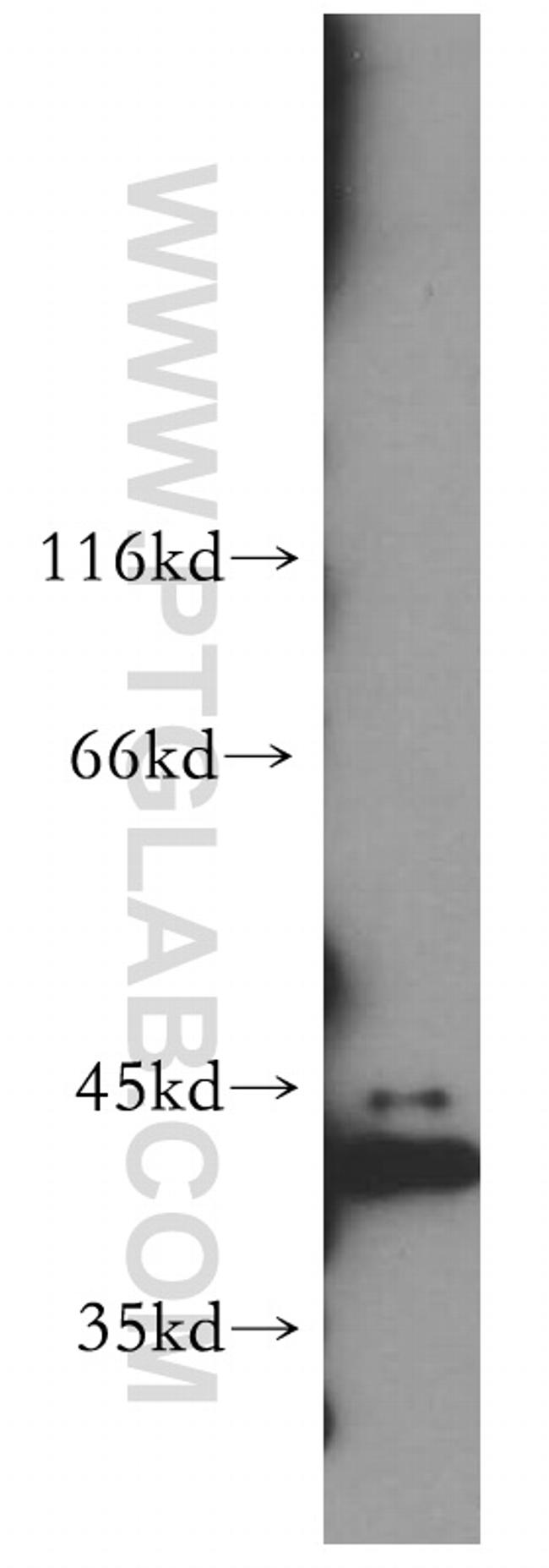 PRPSAP2 Antibody in Western Blot (WB)