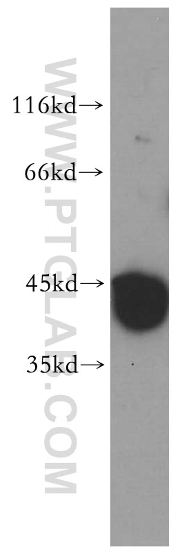 PRPSAP2 Antibody in Western Blot (WB)