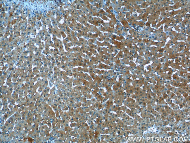 Syntaxin 17 Antibody in Immunohistochemistry (Paraffin) (IHC (P))