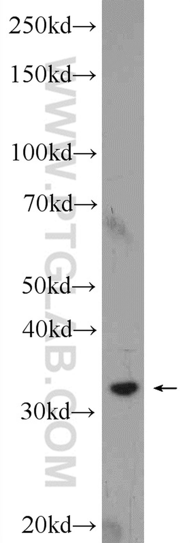 Syntaxin 17 Antibody in Western Blot (WB)