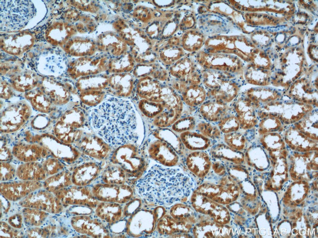 Syntaxin 17 Antibody in Immunohistochemistry (Paraffin) (IHC (P))