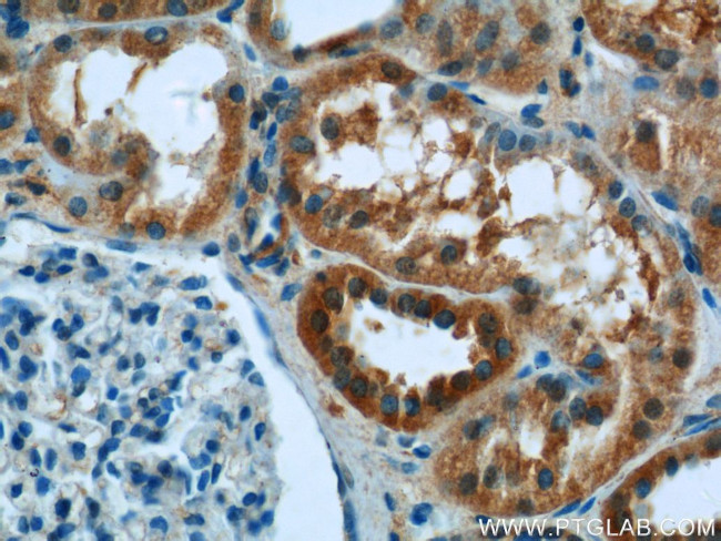 Syntaxin 17 Antibody in Immunohistochemistry (Paraffin) (IHC (P))