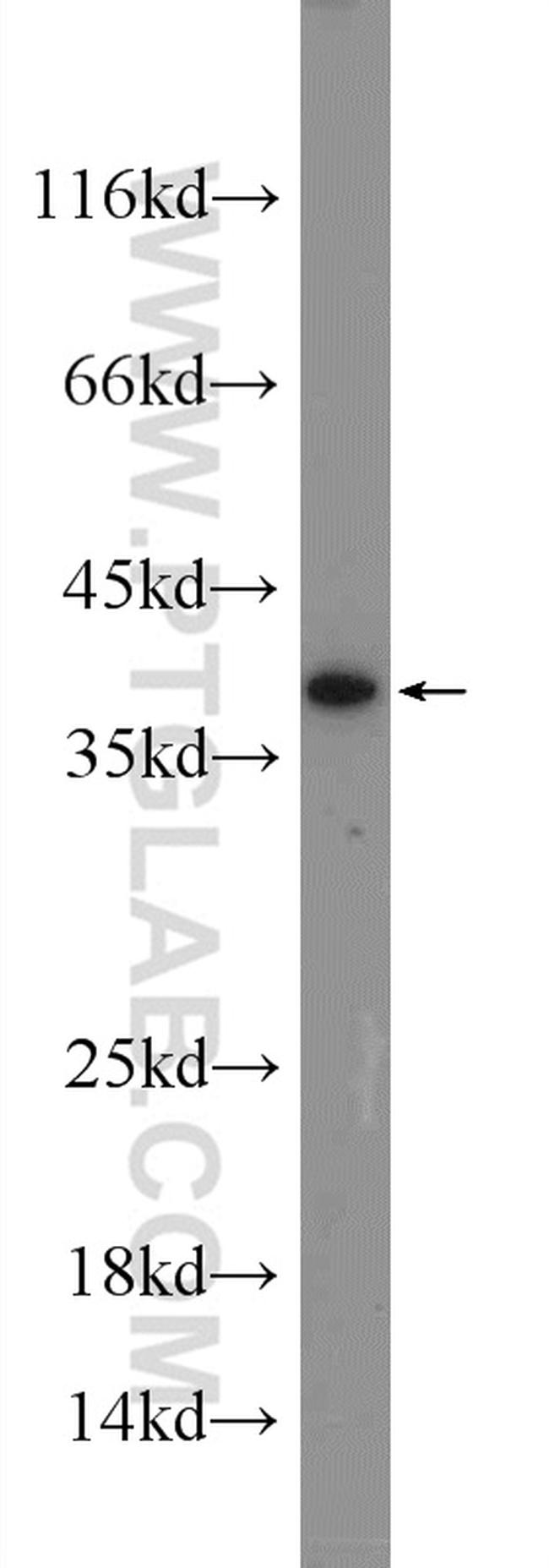 Syntaxin 17 Antibody in Western Blot (WB)