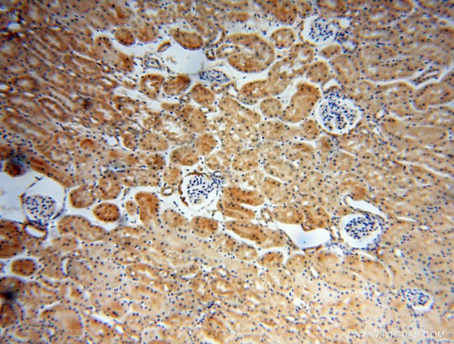 RABL2A Antibody in Immunohistochemistry (Paraffin) (IHC (P))